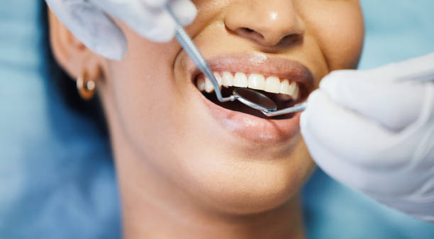 Best Broken or Chipped Tooth Repair in Fort Scott, KS